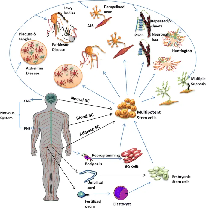 Um gráfico ilustrando as possíveis doenças que os tratamentos com células-tronco poderiam abordar no campo da neurologia.