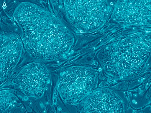 Como maximizar os benefícios da sua Terapia com Células-Tronco