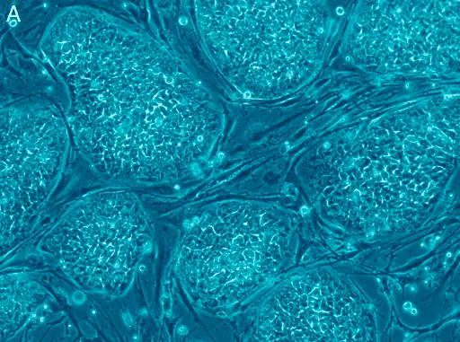 Células-tronco pluripotentes para medicina regenerativa