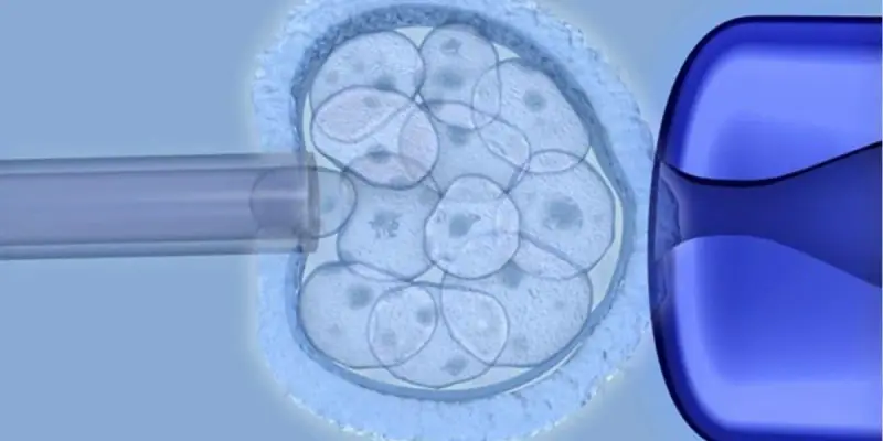 Estudo revela que células-tronco derivadas do cordão umbilical são eficazes em pacientes com paralisia cerebral